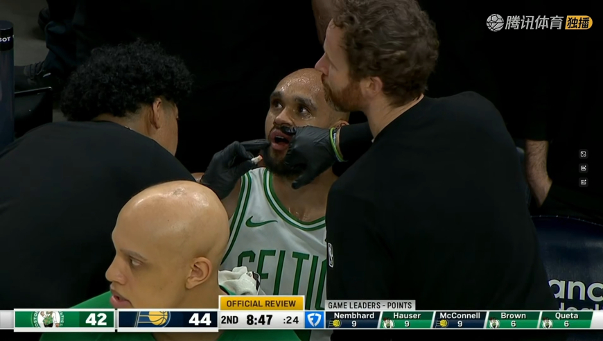 教练气坏了！内姆布哈德上篮时肘击怀特 后者满嘴鲜血裁判拒绝升级