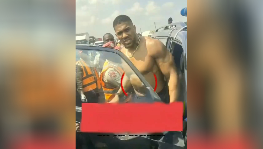 肌肉救了他一命？安东尼约书亚车祸背后的三大关键｜体坛记忆