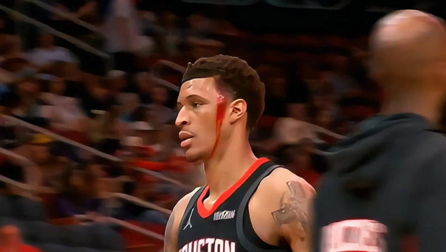 这样的队友谁不爱？火箭小贾巴里vs鹈鹕集锦：被打破头+投进关键三分