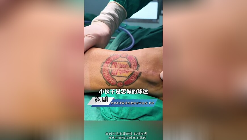 七年前做手术导致队徽文身被分割，曼联球迷做疤痕整形盼王者归来