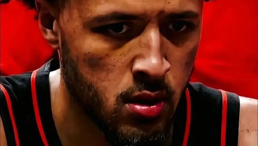 不打了！坎宁安肺部塌陷！NBA状元无限期休战