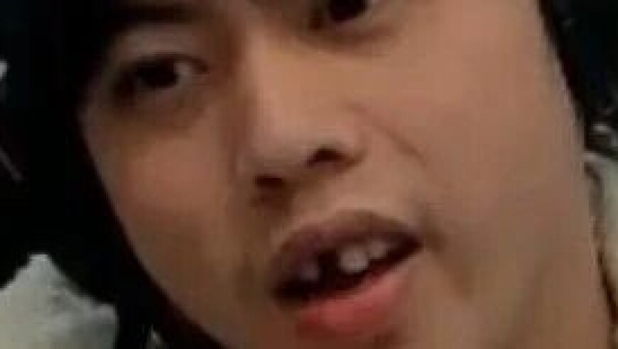 哥们你牙呢？阿乐直播大变样，门牙疑似消失变老头！网友猜测：不是宁王干的吧？