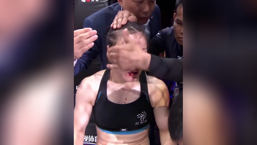体坛记忆｜血染八角笼！张伟丽断鼻逆袭，肘击终结强敌！