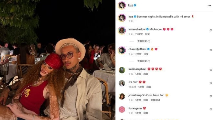 库兹马晒与白癜风超模未婚妻甜蜜依偎照片！亲昵称呼对方是爱人
