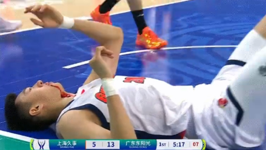 惨烈！王少杰鼻子被打出血被迫下场治疗引关注 杜锋脸如铁色