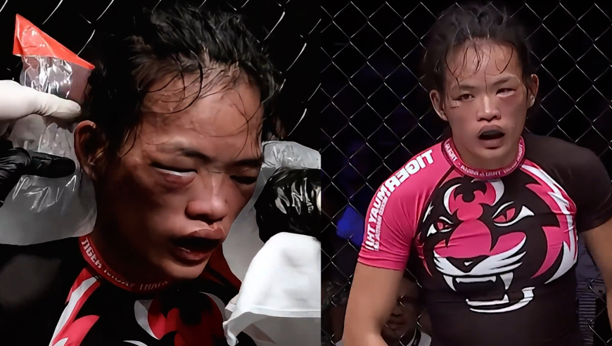 山东姑娘狂轰1000多拳，外国姑娘被打的鼻青脸肿，堪比整容现场