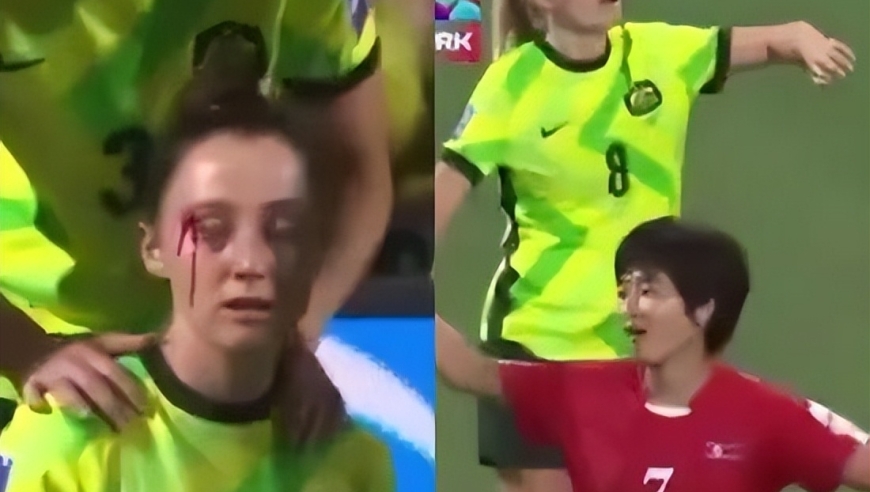 &ldquo;对手球员血流不止&rdquo; ，女足亚洲杯上朝鲜的暴力足球，亚足联为何坐视不管？