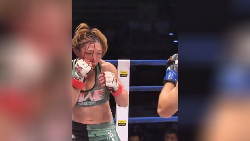 体坛记忆｜日本主场又怎样？张伟丽展开白刃战，打到对手面目全非！