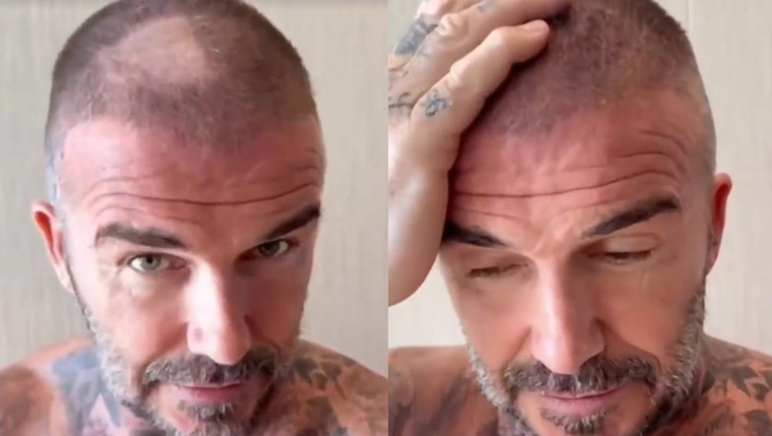 贝克汉姆二月二剪发翻车！剪出&ldquo;斑秃&rdquo;直呼&ldquo;不好笑&rdquo;，在线求补救方法